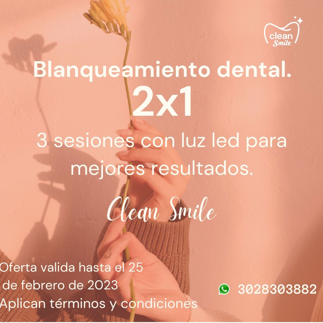 servicio_2